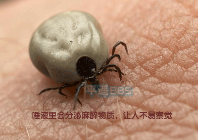 衛(wèi)生部發(fā)布“蜱的特點(diǎn)及預(yù)防控制知識(shí)”