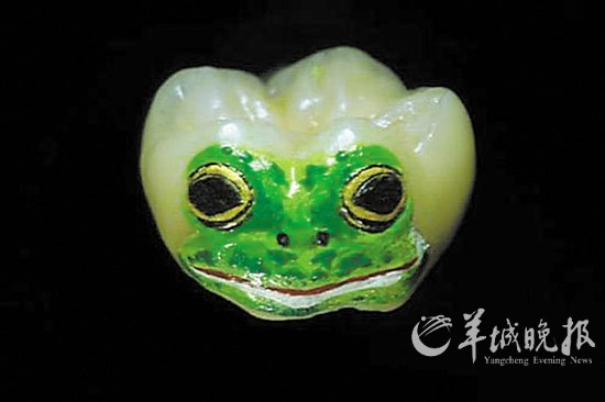 給牙齒做“文身”