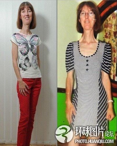 難以置信的罕見怪病：忘記呼吸 靜電過敏 聽鬧鐘響心臟停跳