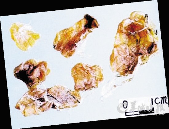 盤點(diǎn)動物糞便6大妙用：抹香鯨糞便可做香水