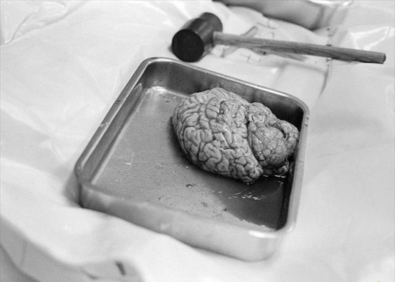 揭秘犯罪鑒證法醫(yī)如何讓死者“說話”