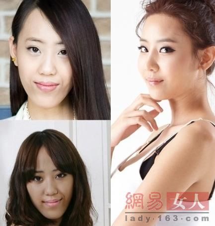 丑女變靚妹！韓國整容節目爆紅