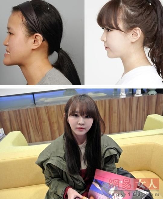 丑女變靚妹！韓國整容節目爆紅