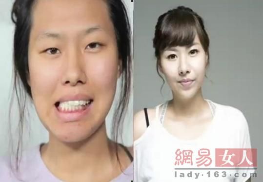 丑女變靚妹！韓國(guó)整容節(jié)目爆紅