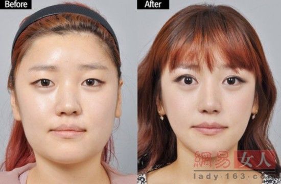丑女變靚妹！韓國整容節(jié)目爆紅