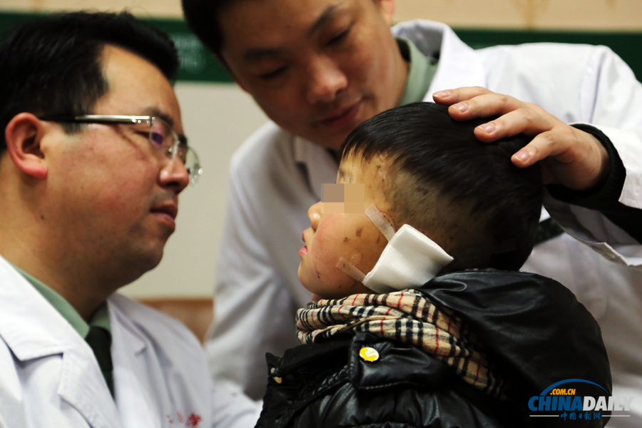 6歲男童慘遭嬸嬸割耳續：有醫院免費為他造左耳