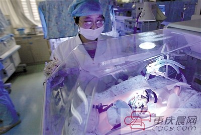 23周！重慶第一早產兒“筷子寶寶”正在頑強存活著