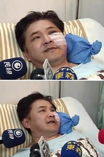 孫紅雷小沈陽打架高峰斗歐 揭娛樂圈打人事件(圖)