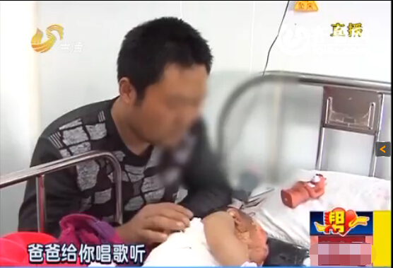 棗莊一歲男嬰被滾燙熱水從頭澆下 大面積嚴(yán)重燙傷
