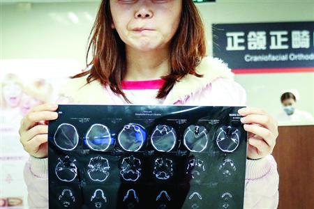 30歲女白領花費14萬元赴韓整形失敗 或永無復原可能