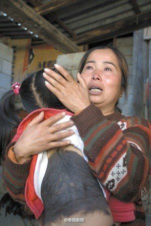 云南3歲女童長(zhǎng)“毛毛背” 醫(yī)院查不出病因(圖)