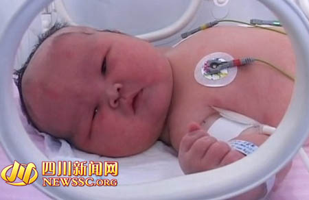 南充高齡產(chǎn)婦產(chǎn)下12.5斤重巨嬰 占滿保育箱