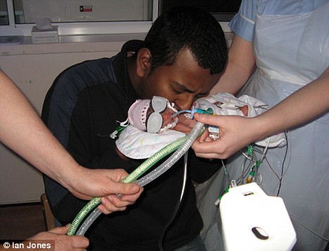 腦瘤引發腦溢血 英國女子死后兩天產下健康女嬰