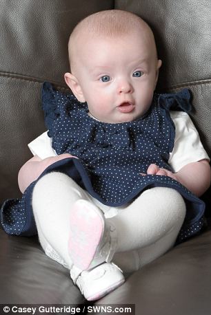 英國一新生兒體內幾乎無血 輸血后奇跡存活