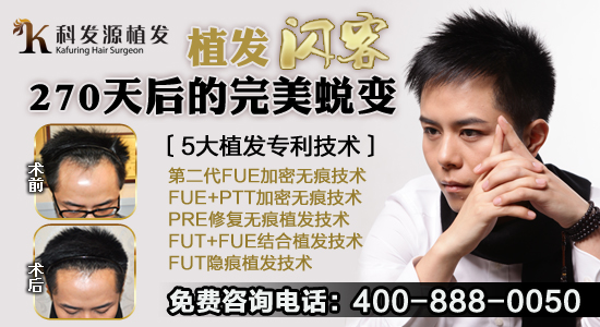 脫發的原因有哪些?科發源揭秘脫發三大原因