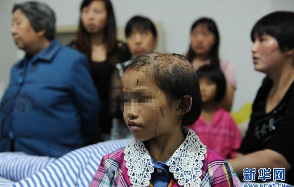男子虐待親生女5年：開水燙頭、魚線縫嘴、跪碎玻璃(圖)