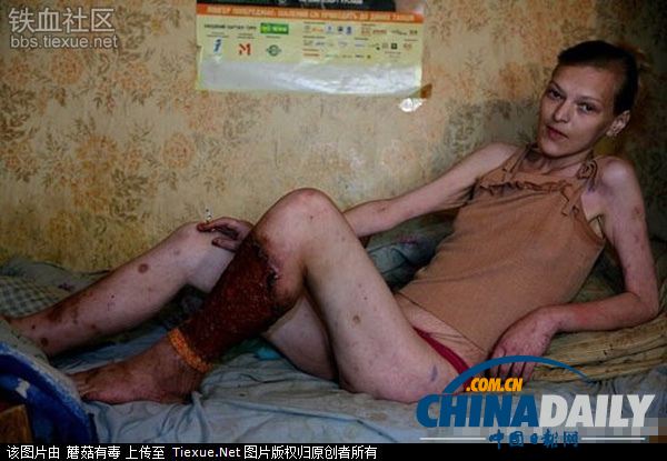 美麗蛻變！實拍吸毒女孩的戒毒歷程