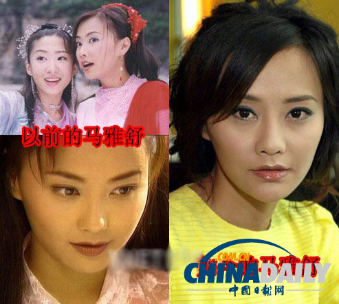 柳巖李小璐楊冪　女星整容前驚人對(duì)比照