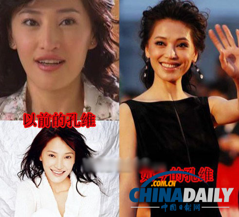 柳巖李小璐楊冪　女星整容前驚人對比照