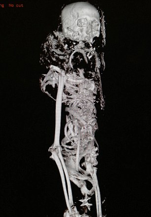 4000歲木乃伊接受CT掃描 “理想患者”毫發(fā)無損