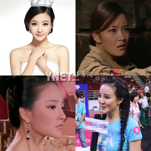 明星整容慘面癱 大S李小璐越發(fā)詭異