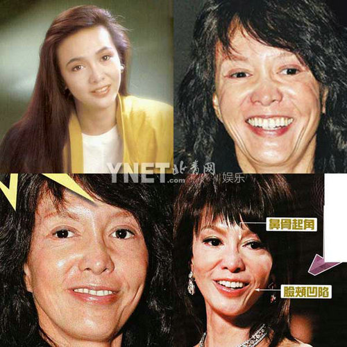 明星整容慘面癱 大S李小璐越發(fā)詭異