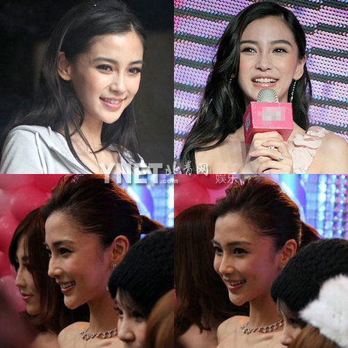 明星整容慘面癱 大S李小璐越發詭異