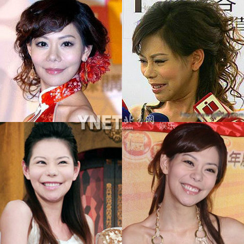 明星整容慘面癱 大S李小璐越發(fā)詭異