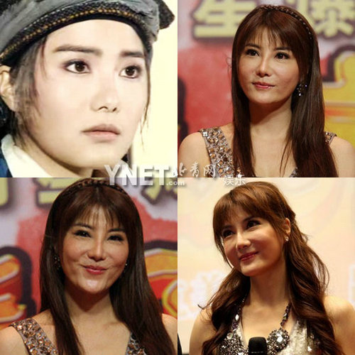 明星整容慘面癱 大S李小璐越發(fā)詭異