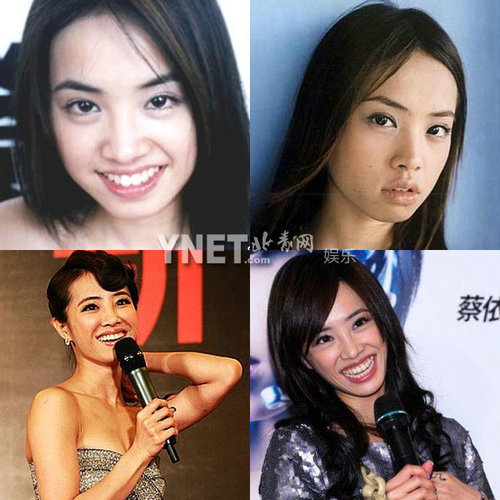 明星整容慘面癱 大S李小璐越發詭異