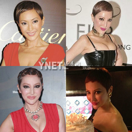 明星整容慘面癱 大S李小璐越發(fā)詭異