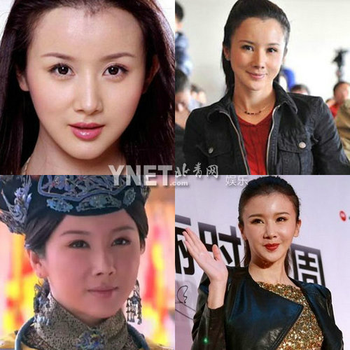 明星整容慘面癱 大S李小璐越發詭異