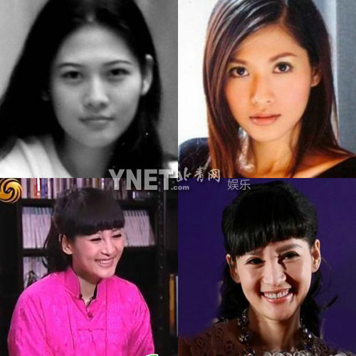 明星整容慘面癱 大S李小璐越發(fā)詭異