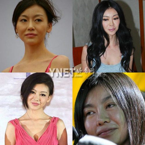 明星整容慘面癱 大S李小璐越發(fā)詭異