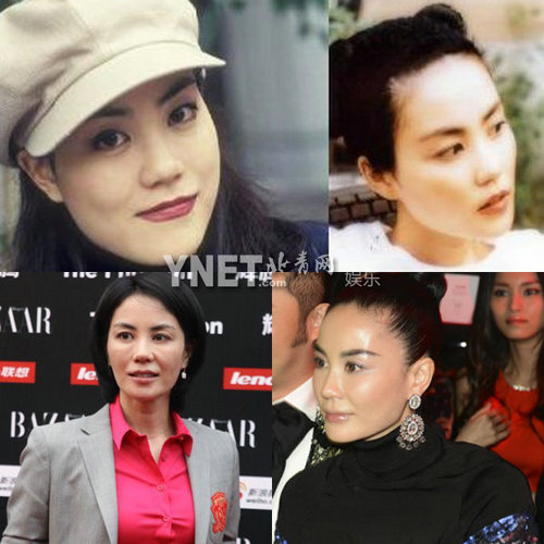 明星整容慘面癱 大S李小璐越發詭異