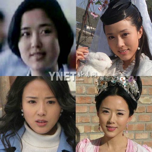 明星整容慘面癱 大S李小璐越發(fā)詭異