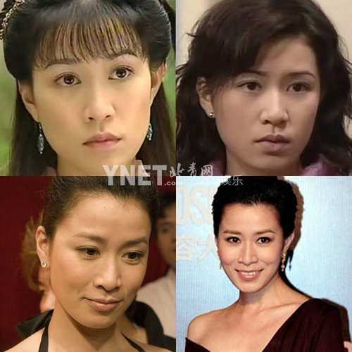 明星整容慘面癱 大S李小璐越發詭異