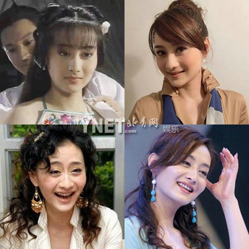 明星整容慘面癱 大S李小璐越發詭異