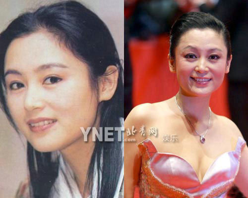 明星整容慘面癱 大S李小璐越發詭異