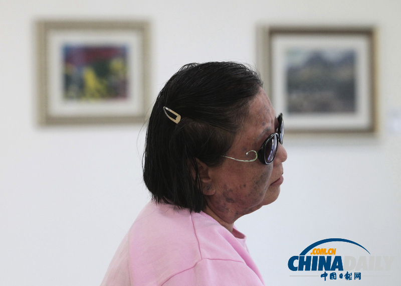 歷史遺留之痛：走近韓國小鹿島麻風病院