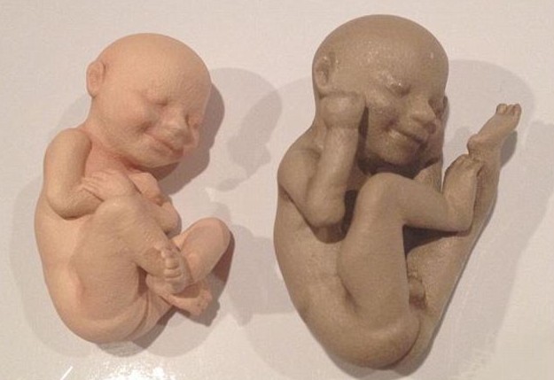 3D打印帶你見未出生胎兒！體位表情皮膚性別皆可見